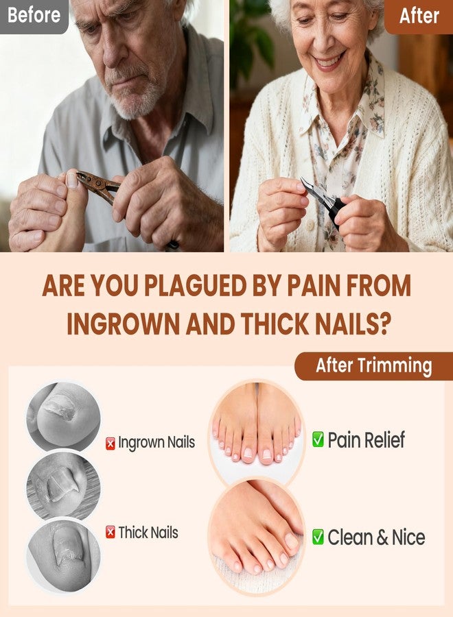 LIONVISON Ingrown Toenail Removal Kit: 8 Pcs Professional Toenail Clippers for Thick Toenails - Heavy Duty Nail Clippers Tools for Seniors Home Foot Care - Image 4